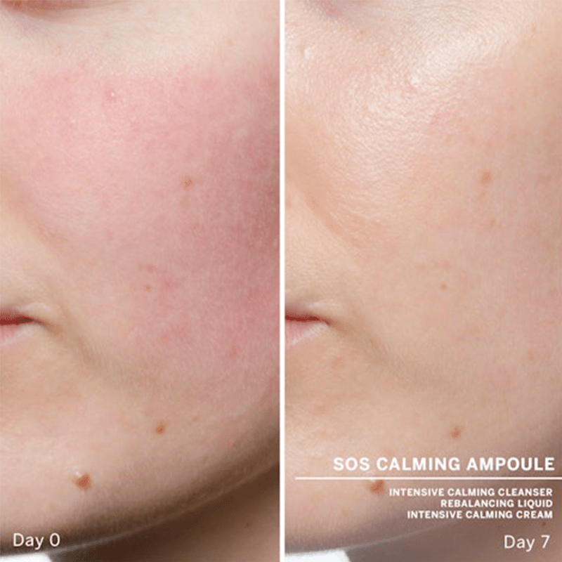 Ampoules : Concentrés SOS Calming - Babor | Carteb