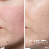Ampoules : Concentrés SOS Calming - Babor | Carteb