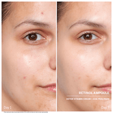 Ampoules : Power Serum Rétinol - Babor | Carteb