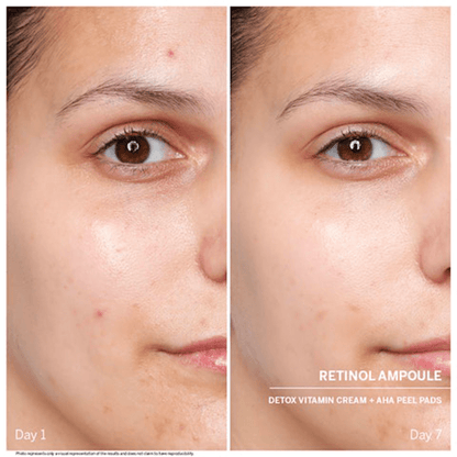 Ampoules : Power Serum Rétinol - Babor | Carteb